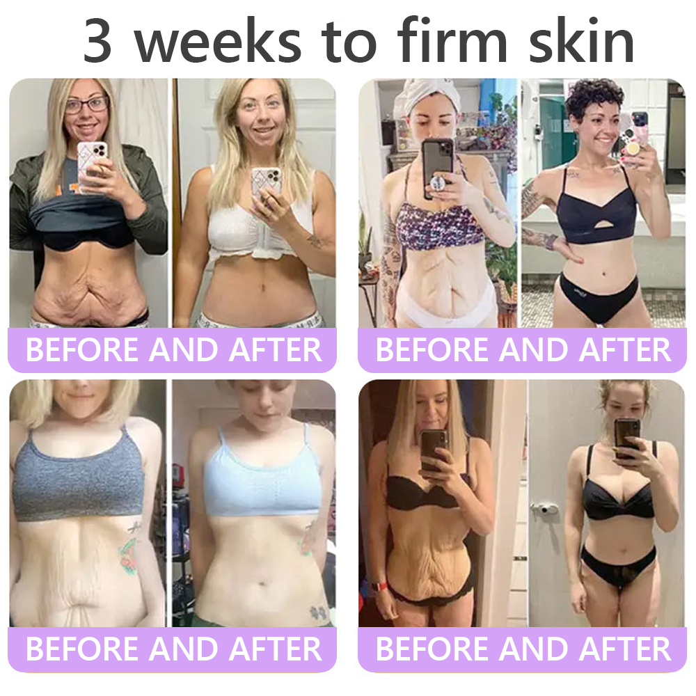 𝑪𝒐𝒏𝒈𝒓𝒂𝒕𝒖𝒍𝒂𝒕𝒊𝒐𝒏𝒔! 𝒀𝒐𝒖’𝒓𝒆 𝒐𝒖𝒓 500𝒕𝒉 𝒄𝒖𝒔𝒕𝒐𝒎𝒆𝒓 𝒕𝒐𝒅𝒂𝒚, 𝒂𝒏𝒅 𝒚𝒐𝒖 𝒈𝒆𝒕 𝒕𝒐 𝒆𝒏𝒋𝒐𝒚 𝒂 𝒔𝒑𝒆𝒄𝒊𝒂𝒍 𝒐𝒇𝒇𝒆𝒓: 𝒂 𝒔𝒆𝒄𝒐𝒏𝒅 𝒑𝒓𝒐𝒅𝒖𝒄𝒕 𝒇𝒐𝒓 30%𝒐𝒇𝒇!HISKIN®