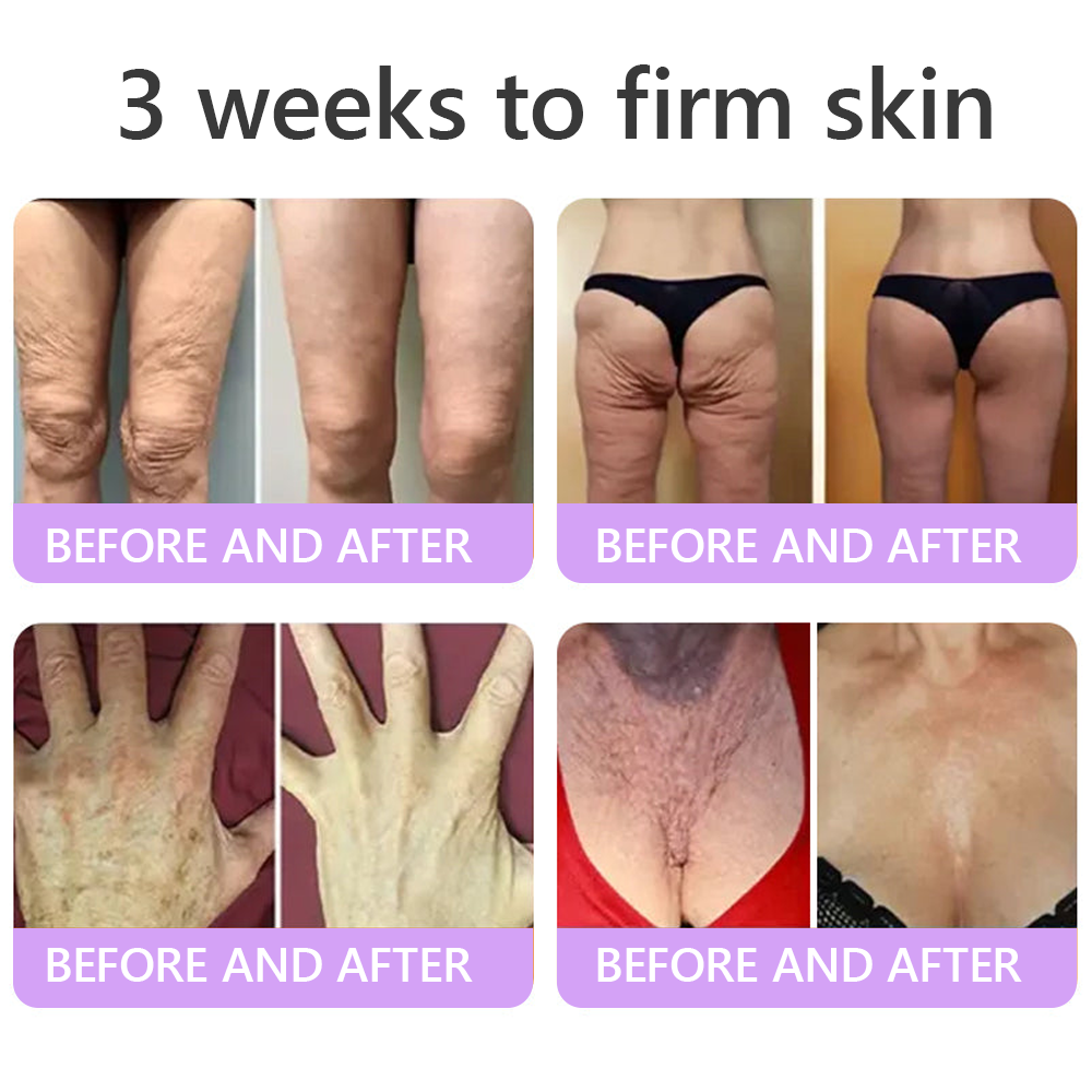 𝑪𝒐𝒏𝒈𝒓𝒂𝒕𝒖𝒍𝒂𝒕𝒊𝒐𝒏𝒔! 𝒀𝒐𝒖’𝒓𝒆 𝒐𝒖𝒓 500𝒕𝒉 𝒄𝒖𝒔𝒕𝒐𝒎𝒆𝒓 𝒕𝒐𝒅𝒂𝒚, 𝒂𝒏𝒅 𝒚𝒐𝒖 𝒈𝒆𝒕 𝒕𝒐 𝒆𝒏𝒋𝒐𝒚 𝒂 𝒔𝒑𝒆𝒄𝒊𝒂𝒍 𝒐𝒇𝒇𝒆𝒓: 𝒂 𝒔𝒆𝒄𝒐𝒏𝒅 𝒑𝒓𝒐𝒅𝒖𝒄𝒕 𝒇𝒐𝒓 30%𝒐𝒇𝒇!HISKIN®