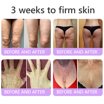 𝑪𝒐𝒏𝒈𝒓𝒂𝒕𝒖𝒍𝒂𝒕𝒊𝒐𝒏𝒔! 𝒀𝒐𝒖’𝒓𝒆 𝒐𝒖𝒓 500𝒕𝒉 𝒄𝒖𝒔𝒕𝒐𝒎𝒆𝒓 𝒕𝒐𝒅𝒂𝒚, 𝒂𝒏𝒅 𝒚𝒐𝒖 𝒈𝒆𝒕 𝒕𝒐 𝒆𝒏𝒋𝒐𝒚 𝒂 𝒔𝒑𝒆𝒄𝒊𝒂𝒍 𝒐𝒇𝒇𝒆𝒓: 𝒂 𝒔𝒆𝒄𝒐𝒏𝒅 𝒑𝒓𝒐𝒅𝒖𝒄𝒕 𝒇𝒐𝒓 30%𝒐𝒇𝒇!HISKIN®