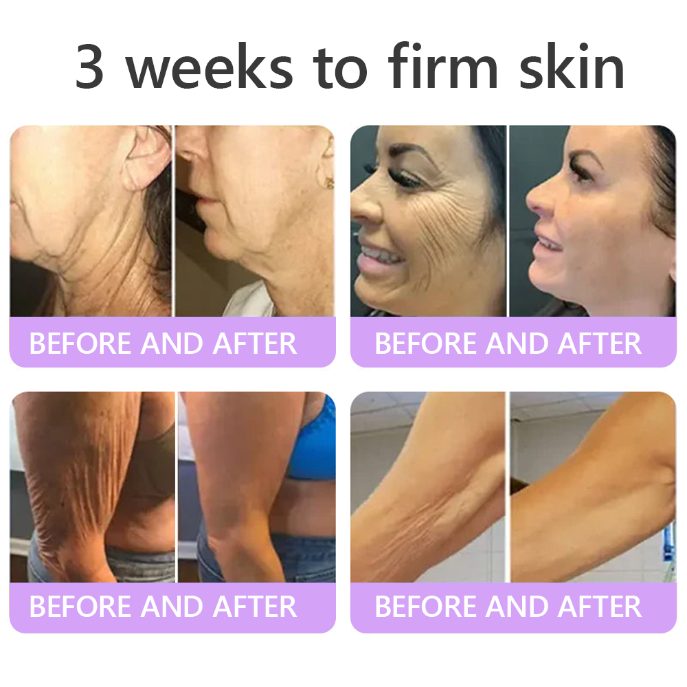 𝑪𝒐𝒏𝒈𝒓𝒂𝒕𝒖𝒍𝒂𝒕𝒊𝒐𝒏𝒔! 𝒀𝒐𝒖’𝒓𝒆 𝒐𝒖𝒓 500𝒕𝒉 𝒄𝒖𝒔𝒕𝒐𝒎𝒆𝒓 𝒕𝒐𝒅𝒂𝒚, 𝒂𝒏𝒅 𝒚𝒐𝒖 𝒈𝒆𝒕 𝒕𝒐 𝒆𝒏𝒋𝒐𝒚 𝒂 𝒔𝒑𝒆𝒄𝒊𝒂𝒍 𝒐𝒇𝒇𝒆𝒓: 𝒂 𝒔𝒆𝒄𝒐𝒏𝒅 𝒑𝒓𝒐𝒅𝒖𝒄𝒕 𝒇𝒐𝒓 30%𝒐𝒇𝒇!HISKIN®