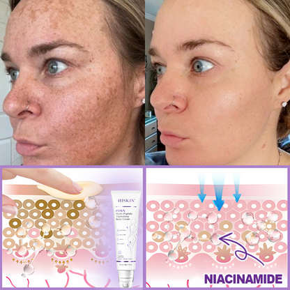 𝑪𝒐𝒏𝒈𝒓𝒂𝒕𝒖𝒍𝒂𝒕𝒊𝒐𝒏𝒔! 𝒀𝒐𝒖’𝒓𝒆 𝒐𝒖𝒓 500𝒕𝒉 𝒄𝒖𝒔𝒕𝒐𝒎𝒆𝒓 𝒕𝒐𝒅𝒂𝒚, 𝒂𝒏𝒅 𝒚𝒐𝒖 𝒈𝒆𝒕 𝒕𝒐 𝒆𝒏𝒋𝒐𝒚 𝒂 𝒔𝒑𝒆𝒄𝒊𝒂𝒍 𝒐𝒇𝒇𝒆𝒓: 𝒂 𝒔𝒆𝒄𝒐𝒏𝒅 𝒑𝒓𝒐𝒅𝒖𝒄𝒕 𝒇𝒐𝒓 30%𝒐𝒇𝒇!HISKIN®