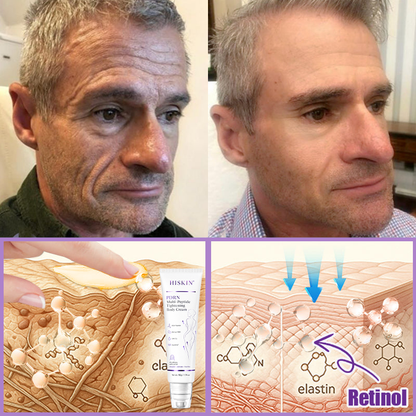𝑪𝒐𝒏𝒈𝒓𝒂𝒕𝒖𝒍𝒂𝒕𝒊𝒐𝒏𝒔! 𝒀𝒐𝒖’𝒓𝒆 𝒐𝒖𝒓 500𝒕𝒉 𝒄𝒖𝒔𝒕𝒐𝒎𝒆𝒓 𝒕𝒐𝒅𝒂𝒚, 𝒂𝒏𝒅 𝒚𝒐𝒖 𝒈𝒆𝒕 𝒕𝒐 𝒆𝒏𝒋𝒐𝒚 𝒂 𝒔𝒑𝒆𝒄𝒊𝒂𝒍 𝒐𝒇𝒇𝒆𝒓: 𝒂 𝒔𝒆𝒄𝒐𝒏𝒅 𝒑𝒓𝒐𝒅𝒖𝒄𝒕 𝒇𝒐𝒓 30%𝒐𝒇𝒇!HISKIN®